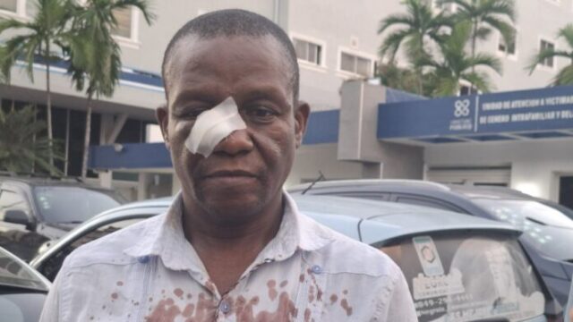 69985cee2fea5-696x392