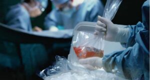 Niños en lista de espera: el desafío de sobrevivir hasta recibir un trasplante
