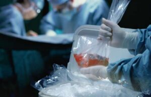 Niños en lista de espera: el desafío de sobrevivir hasta recibir un trasplante